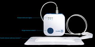 SQU 421554 |BX/5 AVELLE NPWT SYSTEM (12x21)CM (4x13)CM INNER PAD W/ HYDROFIBER CORE & SILICONE ADHESIVE BORDER